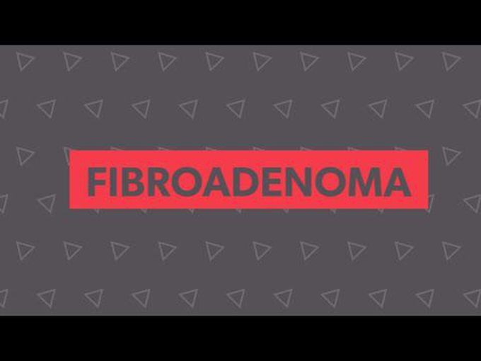 Fibroadenoma