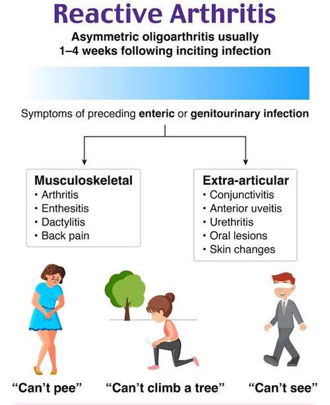 Reactive Arthritis Symptoms