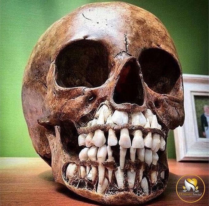 A Child's Skull