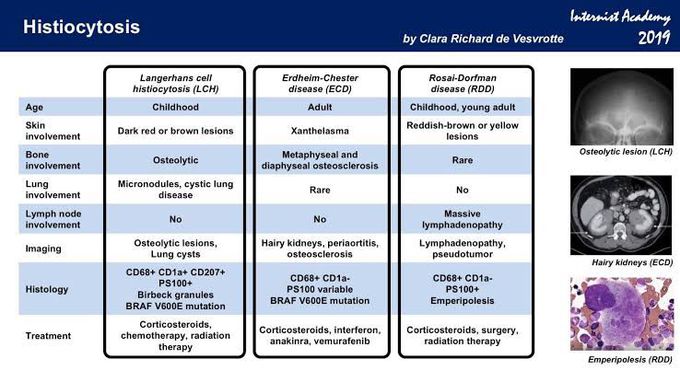 Histiocytosis