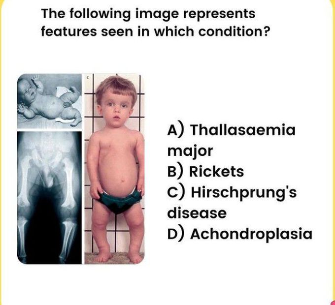 Identify the disease