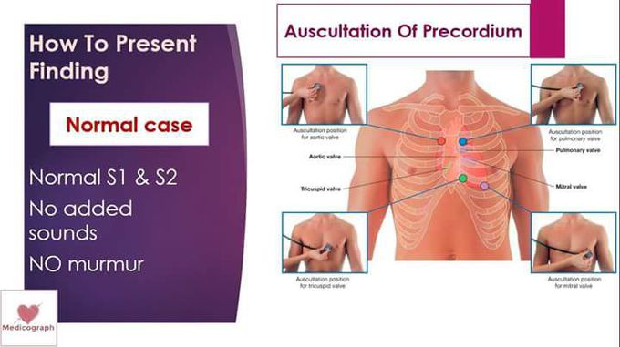 Auscultation of pericardium