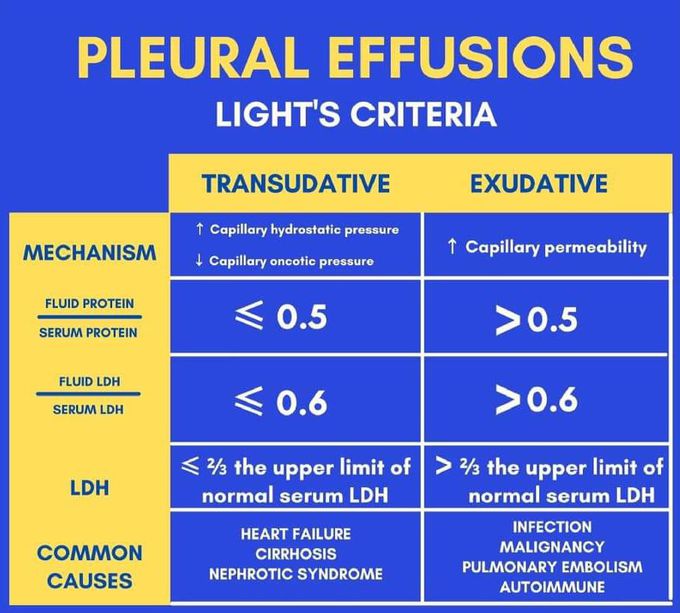 Light's criteria for assessing Pleural Effusion