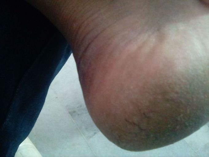 What diagnosis?