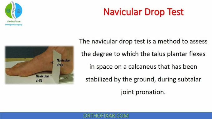 Navicular Drop Test • Easy Explained - OrthoFixar 2022