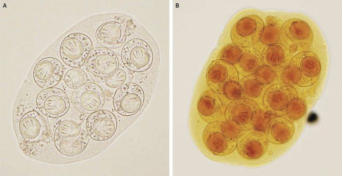 Dipylidium caninum Infection