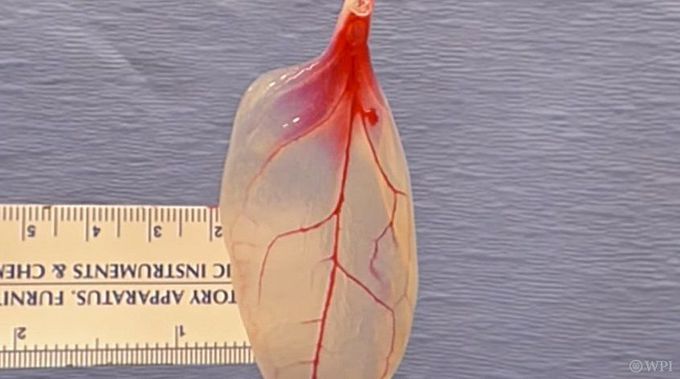 Scientists Use Spinach Leaves to Grow Beating Human Heart Tissue