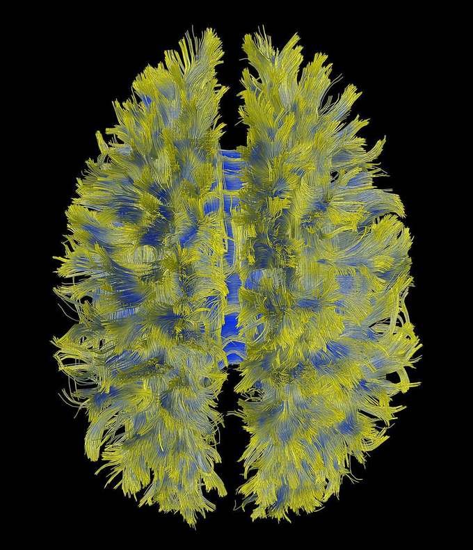 Human cortex