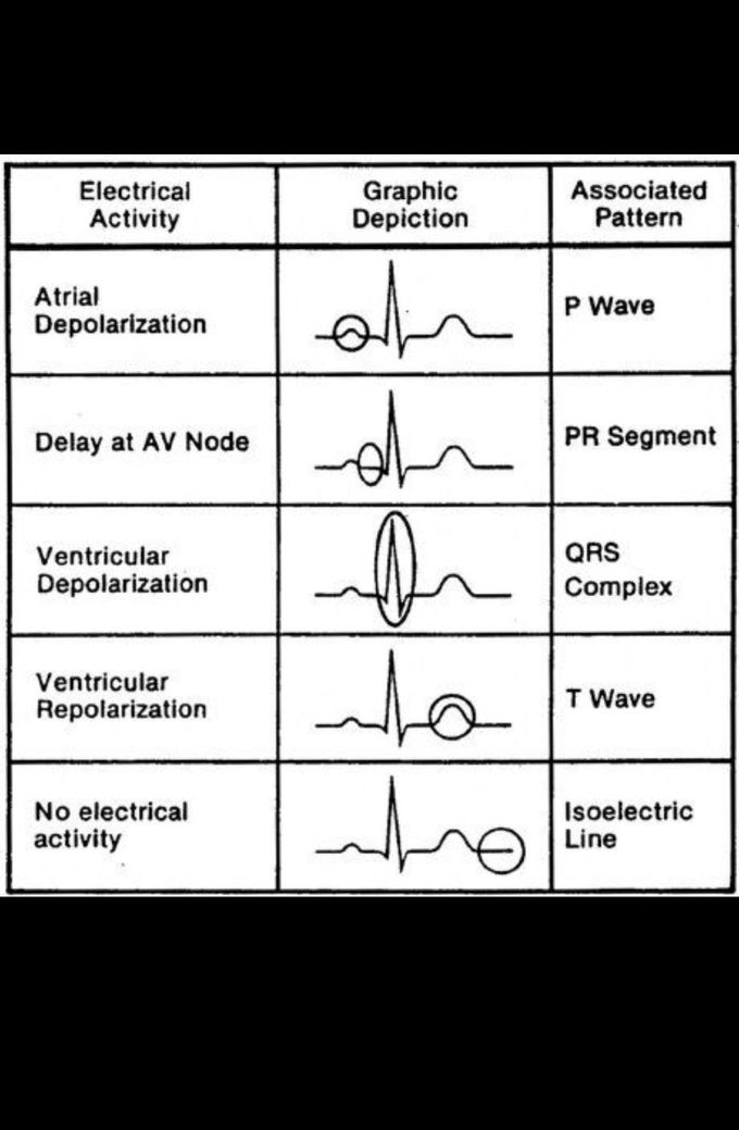 ECG #