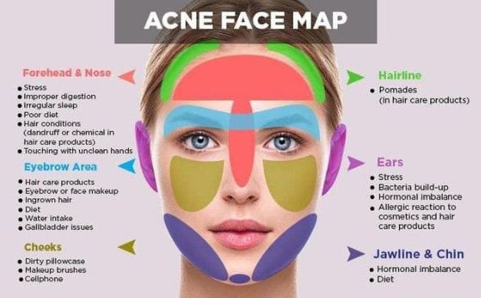 Acne face health