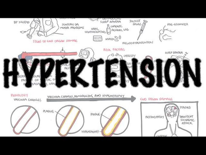 Hypertension