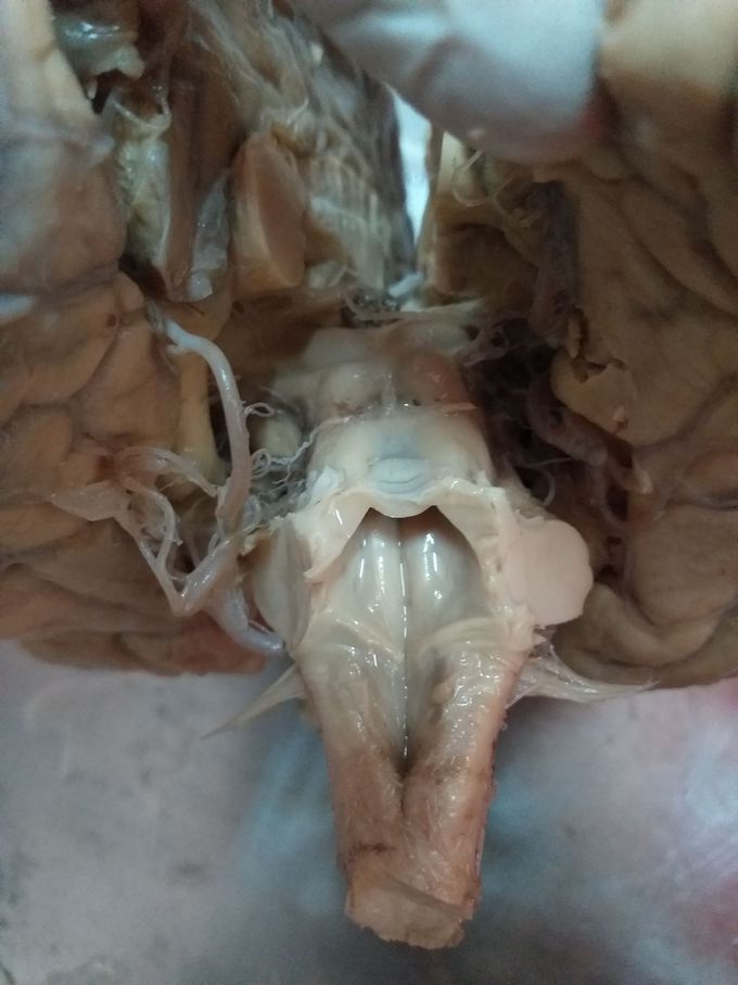 Rhomboid fossa