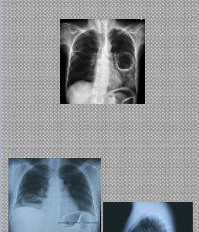 Diagnosis??