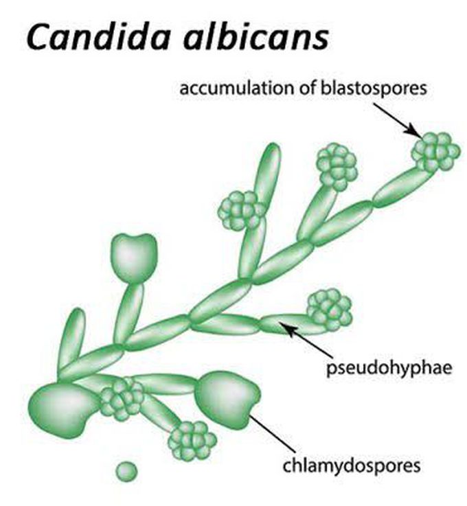 Types of candidiasis