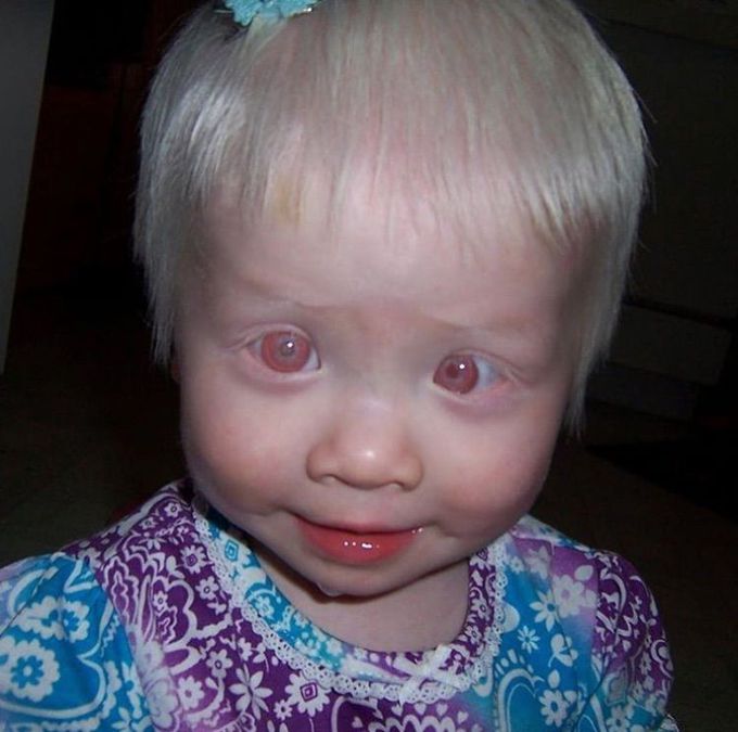 What is your diagnosis ?