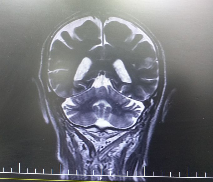 What is your diagnosis?