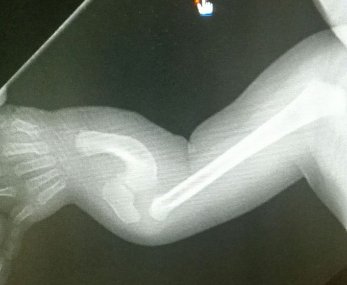 What is your diagnosis?