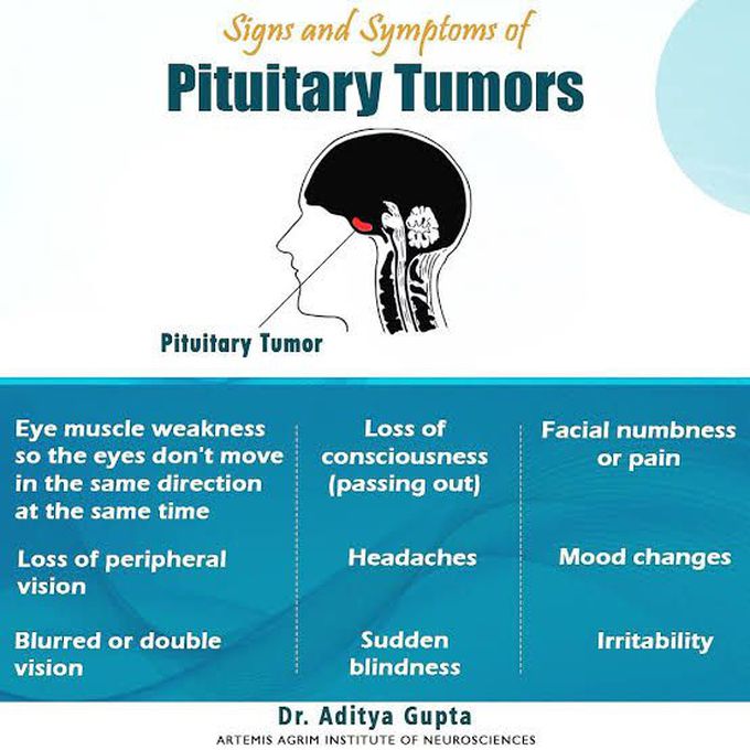 Pituitary adenoma symptoms