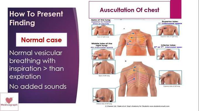 Auscultation of chest