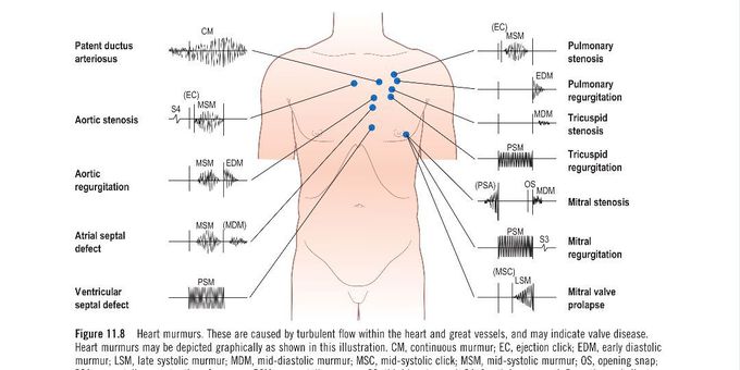 Auscultation areas for murmurs