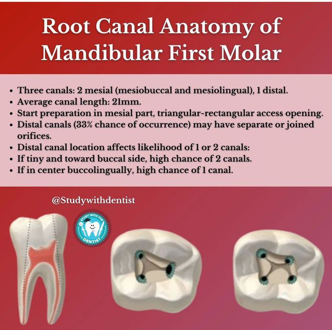Root canal anatomy of mandibular 1st molar medizzy