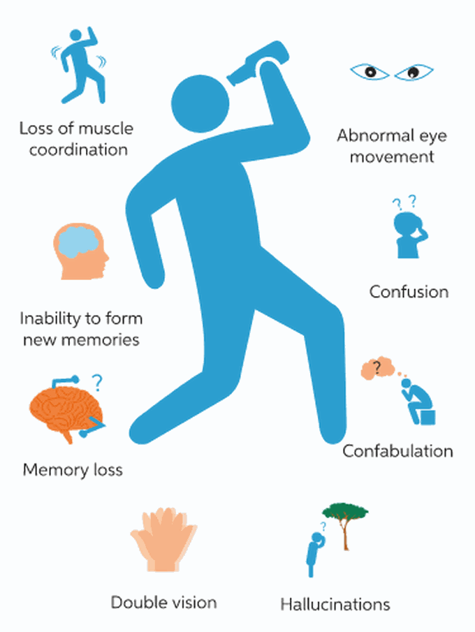 Wernicke s korsakoff syndrome medizzy