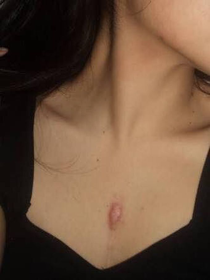 WHAT IS YOUR DIAGNOSIS..?