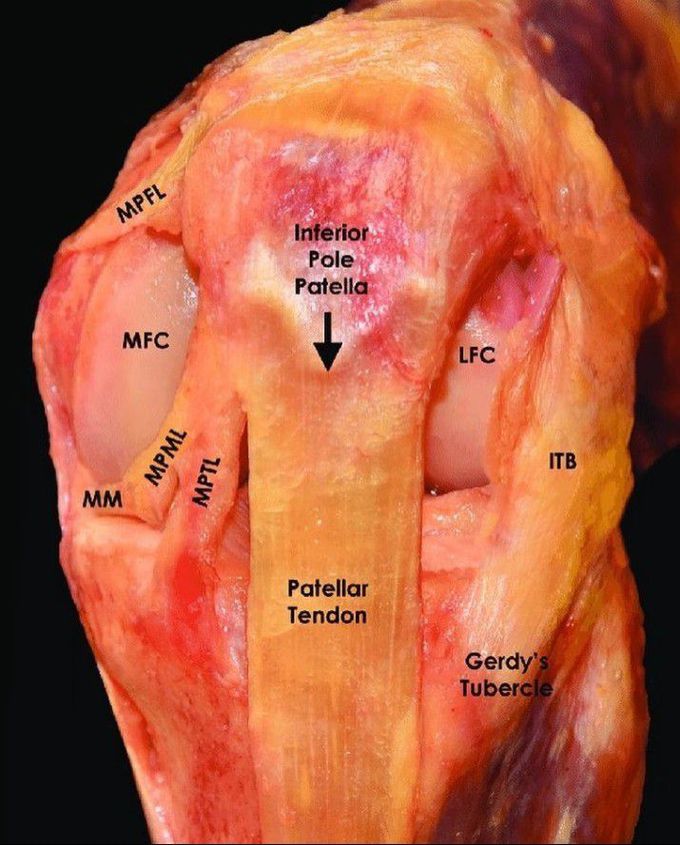 Anterior view of Knee at 90 degree flexion
