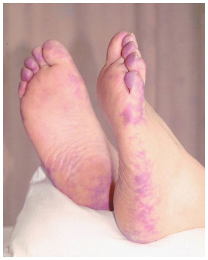 What is your diagnosis?