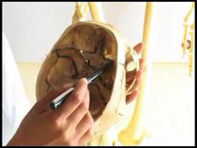 Anatomy of skull- Cranial fossa