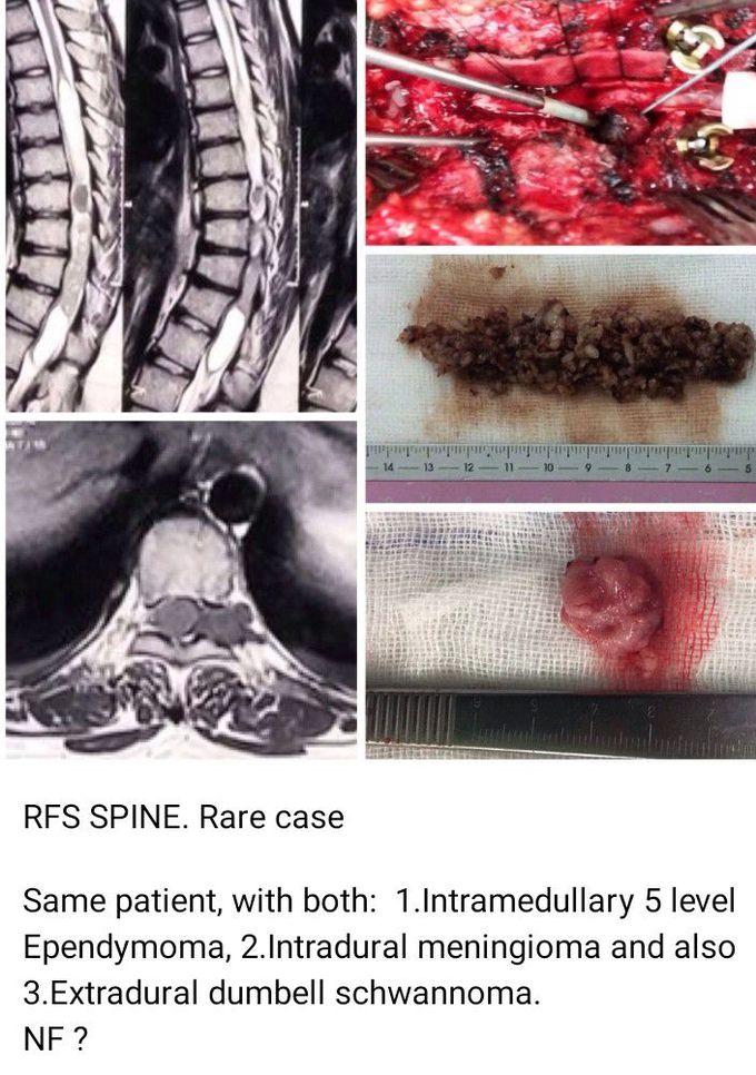 Neurosurgery
