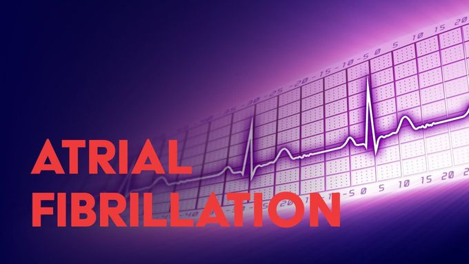 Atrial Fibrillation