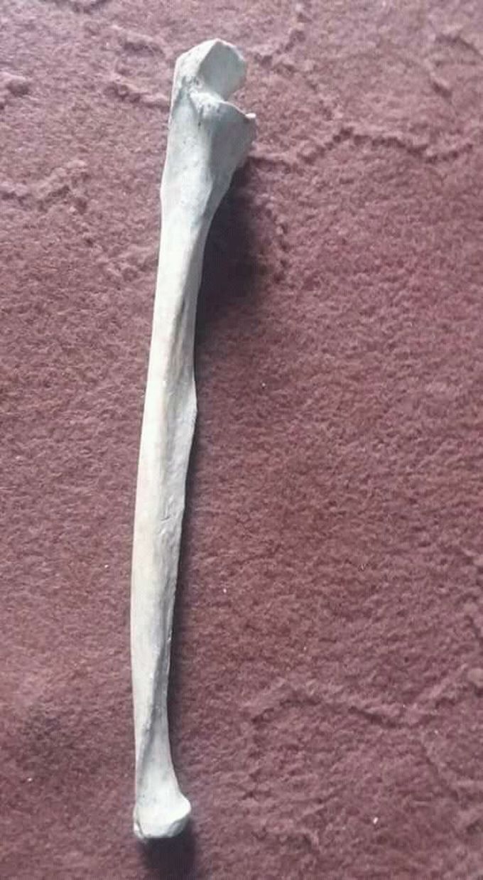 Name this BONE ???