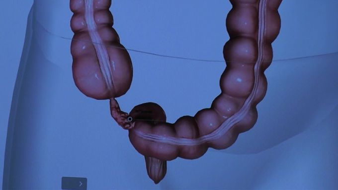 The Anatomy of the Appendix
