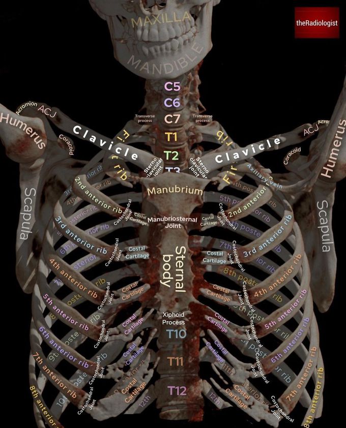 3D CT Thorax