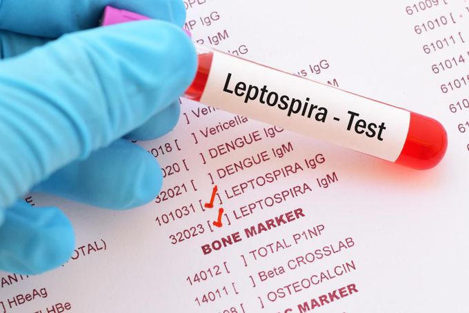 Leptospirosis