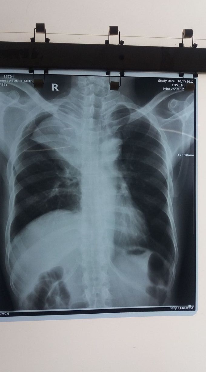 Diagnosis pals????