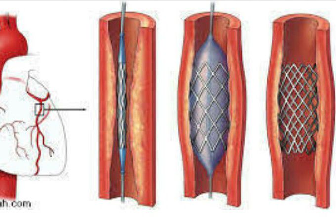 Guess the procedure