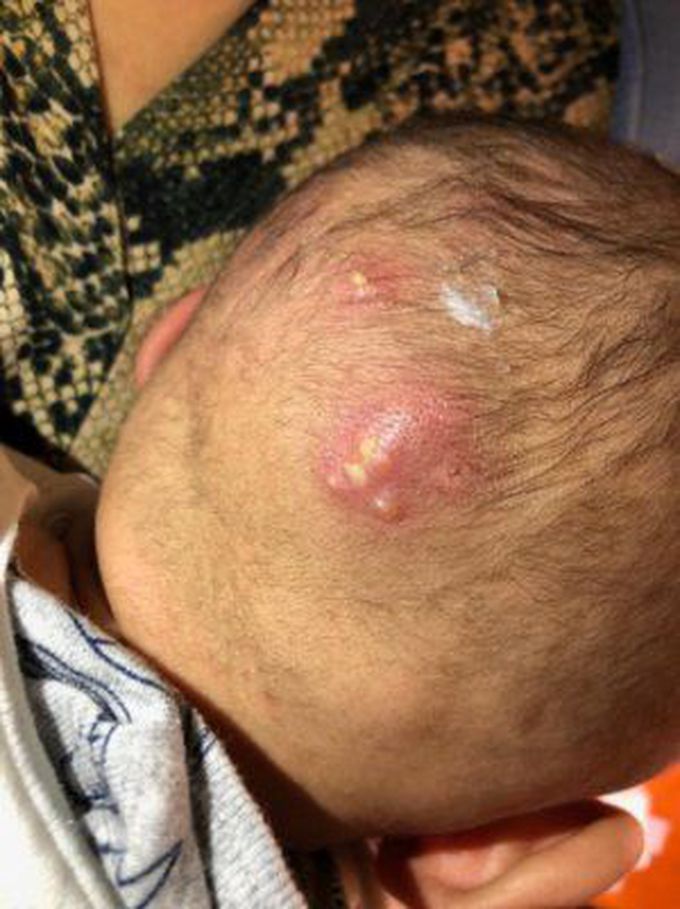 Diagnosis?