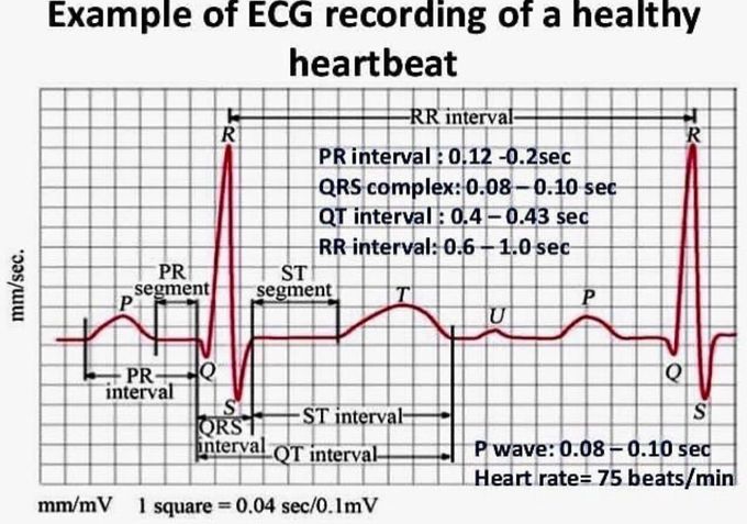 Ecg of healthy heartbeat