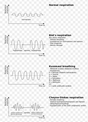 Breathing pattern abnormalities - MEDizzy