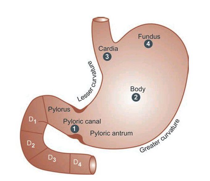 Gastric carcinoma