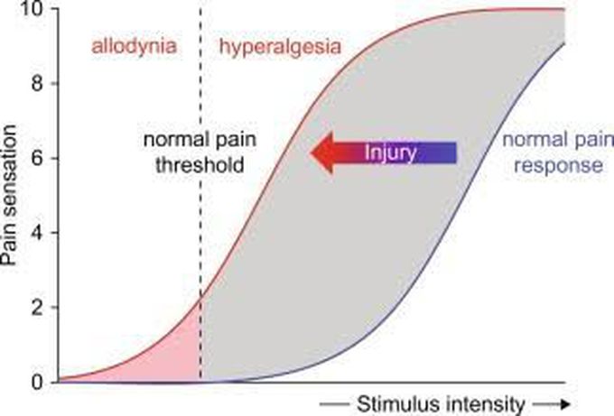 Allodynia