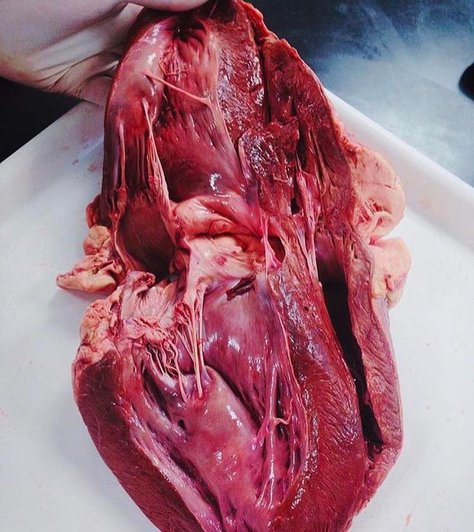 This is how your heart looks like from the inside