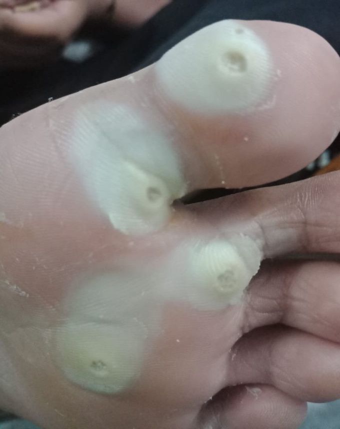 What's diagnosis..?