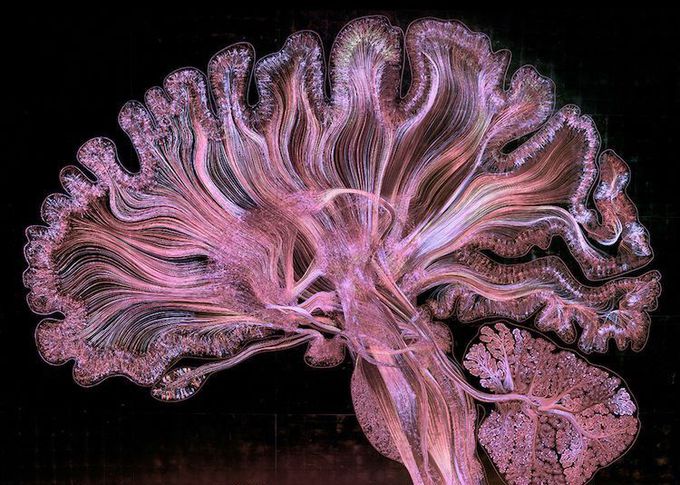 BRAIN
