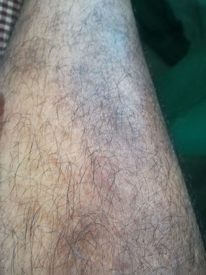 Can anyone one diagnose this?