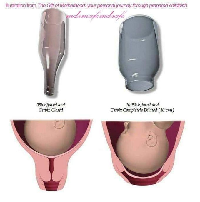 Changes in cervix during labor - MEDizzy
