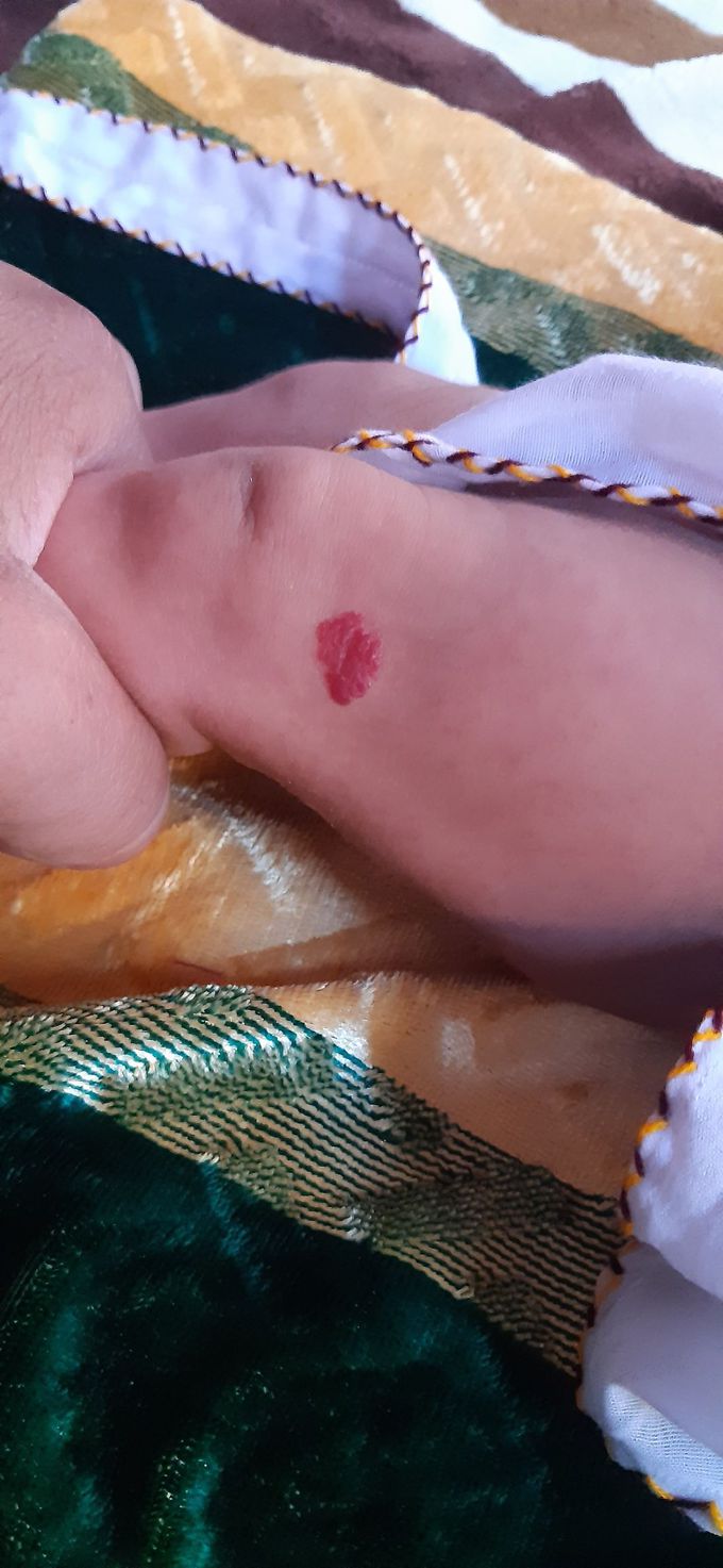 Please diagnosis and treatment