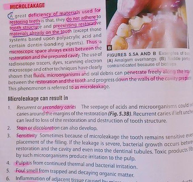 Microleakage